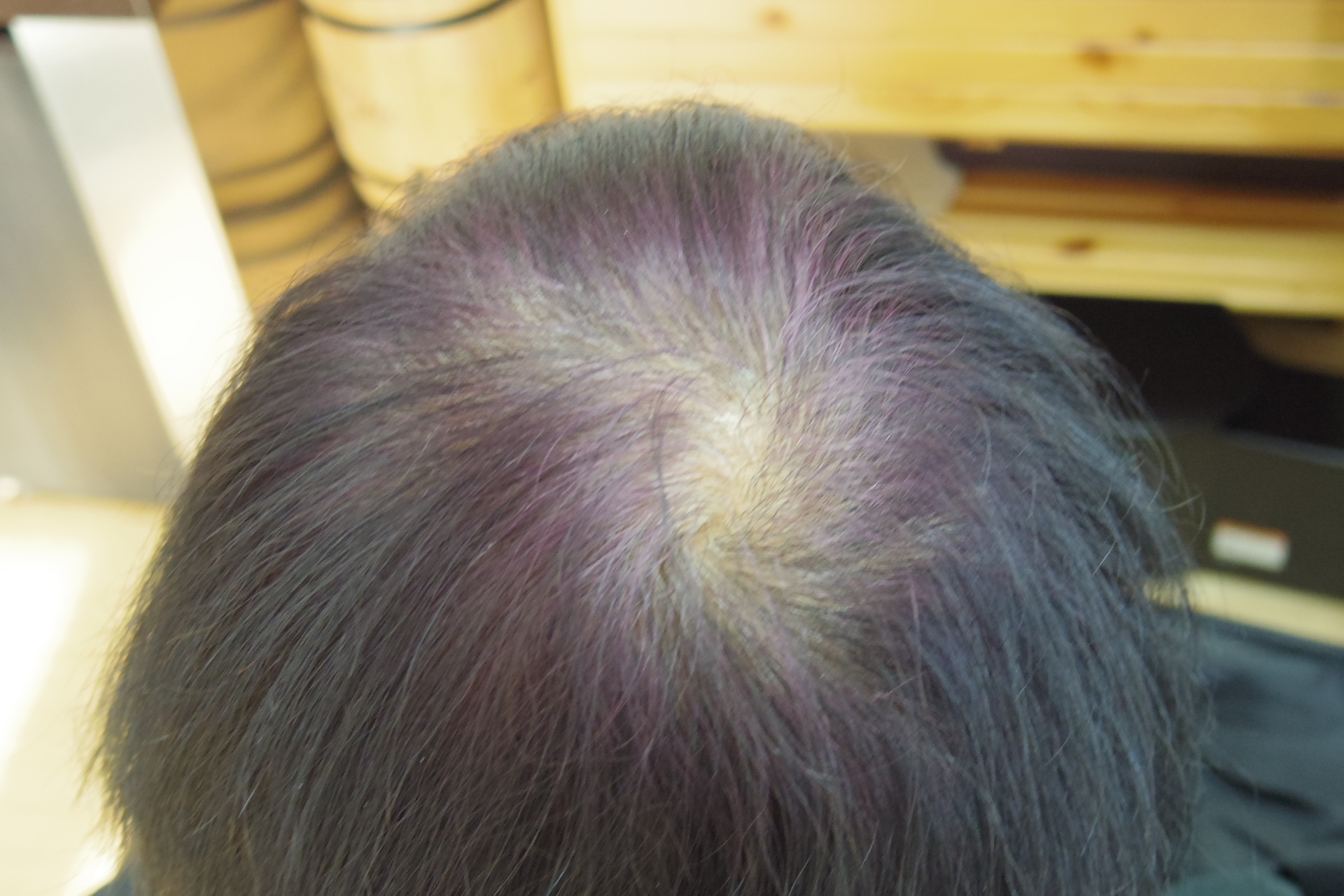 インディゴで白髪を染めるとたまに紫色になる問題 解決方法は ヘナのお悩み相談室